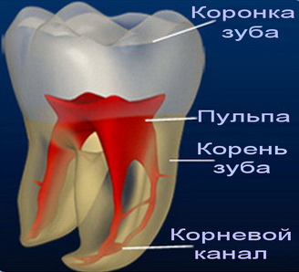 лечение пульпита